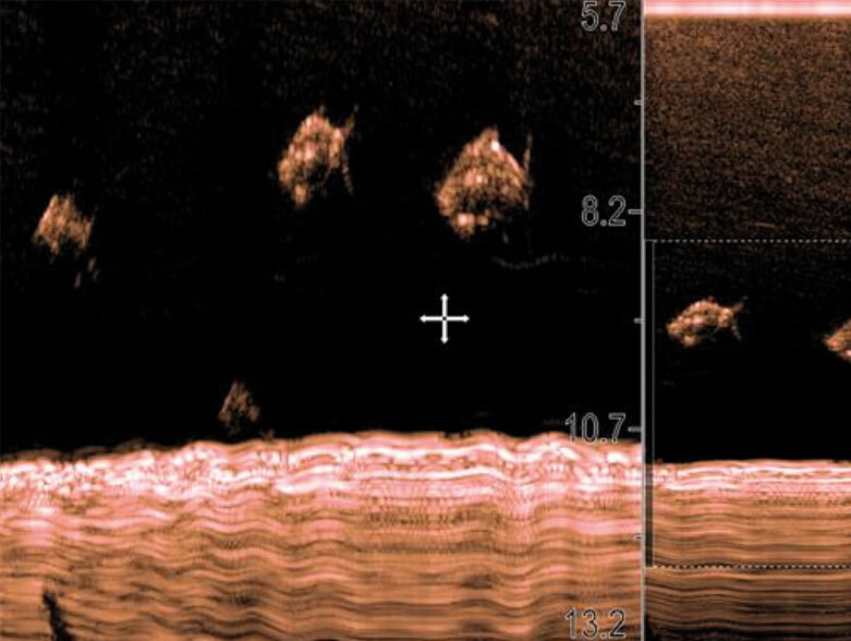 Sonar CHIRP à large spectre